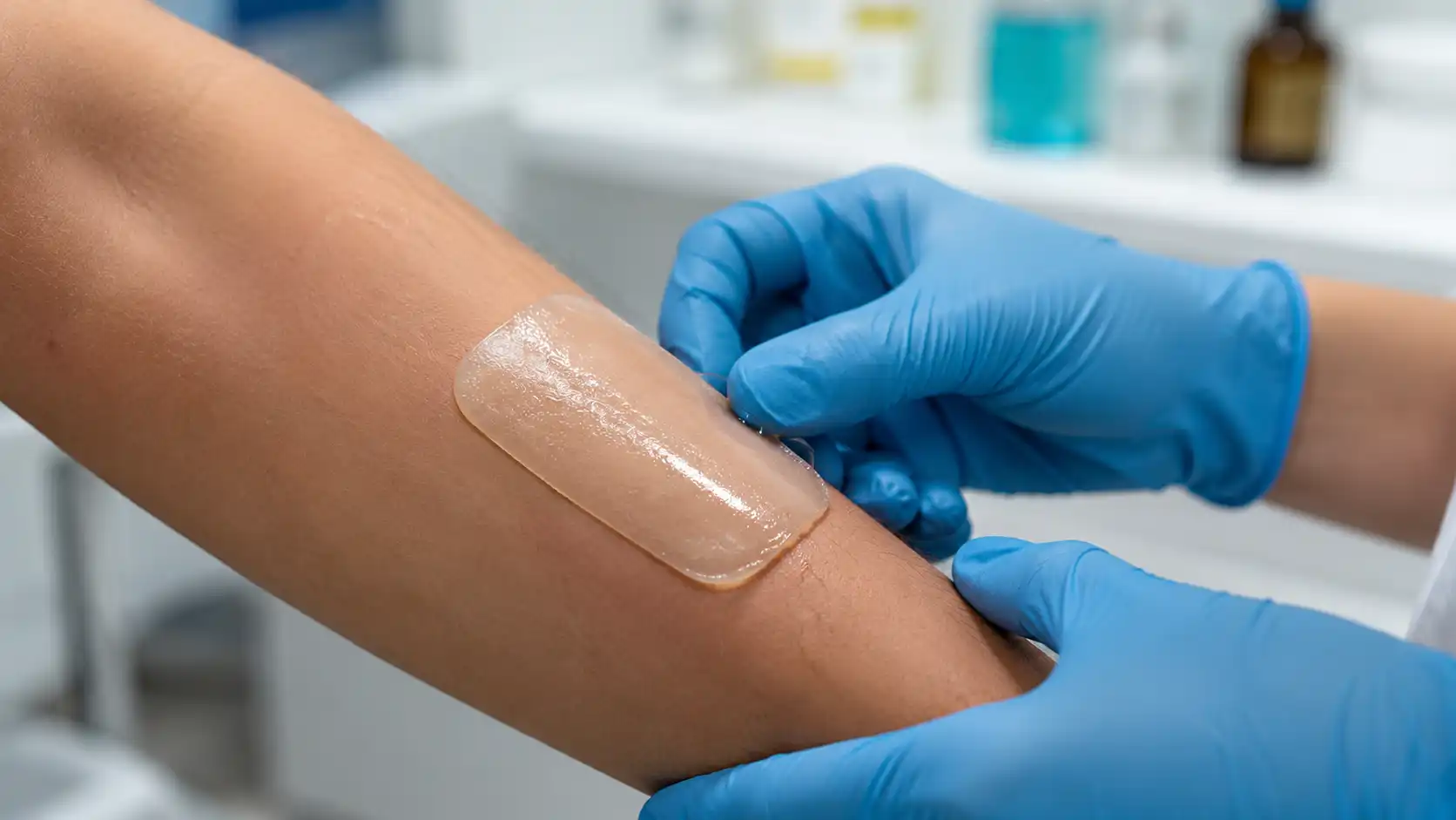 Cette « seconde peau » en hydrogel referme les plaies en quelques heures