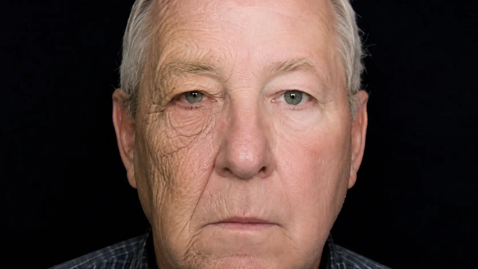 Le chauffeur routier dont le visage raconte les ravages du soleil (et ça fait réfléchir)