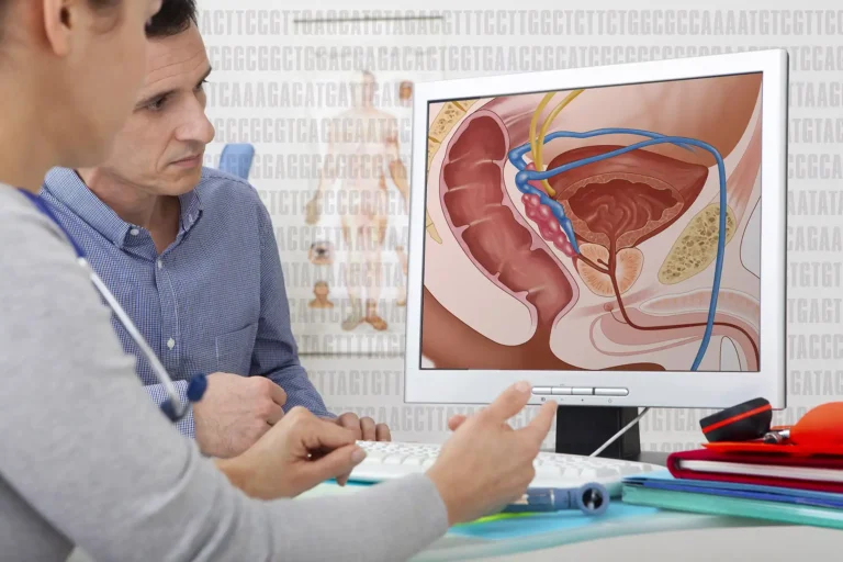 cancer-du-prostate