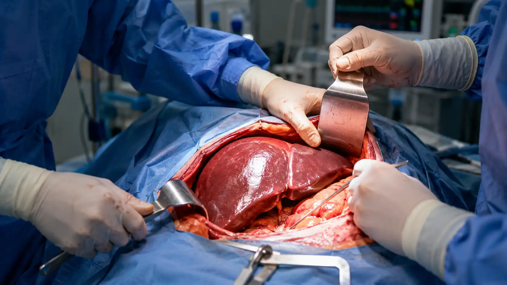 Le foie, cet organe capable de repousser tout seul : mythe ou réalité ?