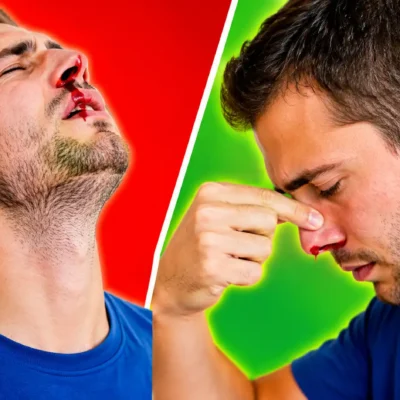 Saignement de nez : l'erreur que tout le monde fait encore (et qui peut être dangereuse)